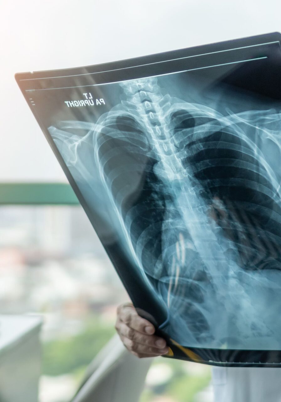 Xray picture in hands of doctor